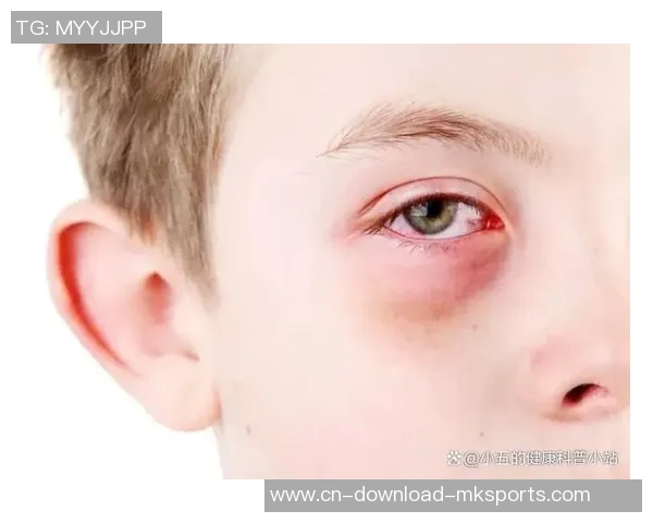 小卡解释鼻子出血原因只是轻微划伤并遭遇眼部意外碰撞